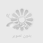 مشاوره ایمپلنت